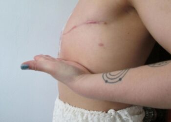 Cancer du sein et de la leucémie: des kits de dépistage produits au Maroc bientôt commercialisés