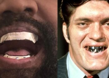 Kanye West Remplace ses Dents par un Ensemble « Plus Cher que le Diamant »