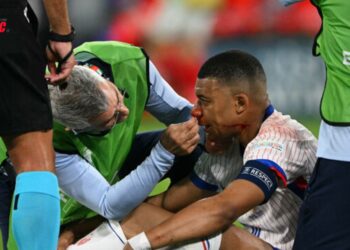 Le nez de Mbappé est ‘cassé’… la durée de son absence est inconnue