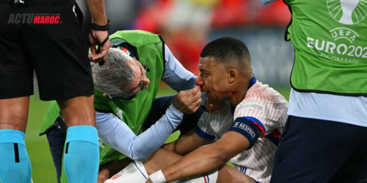 Le nez de Mbappé est ‘cassé’… la durée de son absence est inconnue