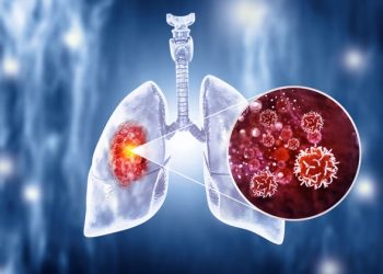 Cancer : des avancées qui changent la donne