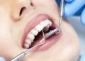 Dentisterie clandestine : l’Ordre des médecins dentistes tire la sonnette d’alarme